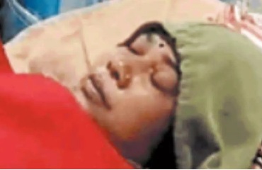 सुसाइड की कोशिश करने वाली विधायक की पत्नी रायपुर रेफर